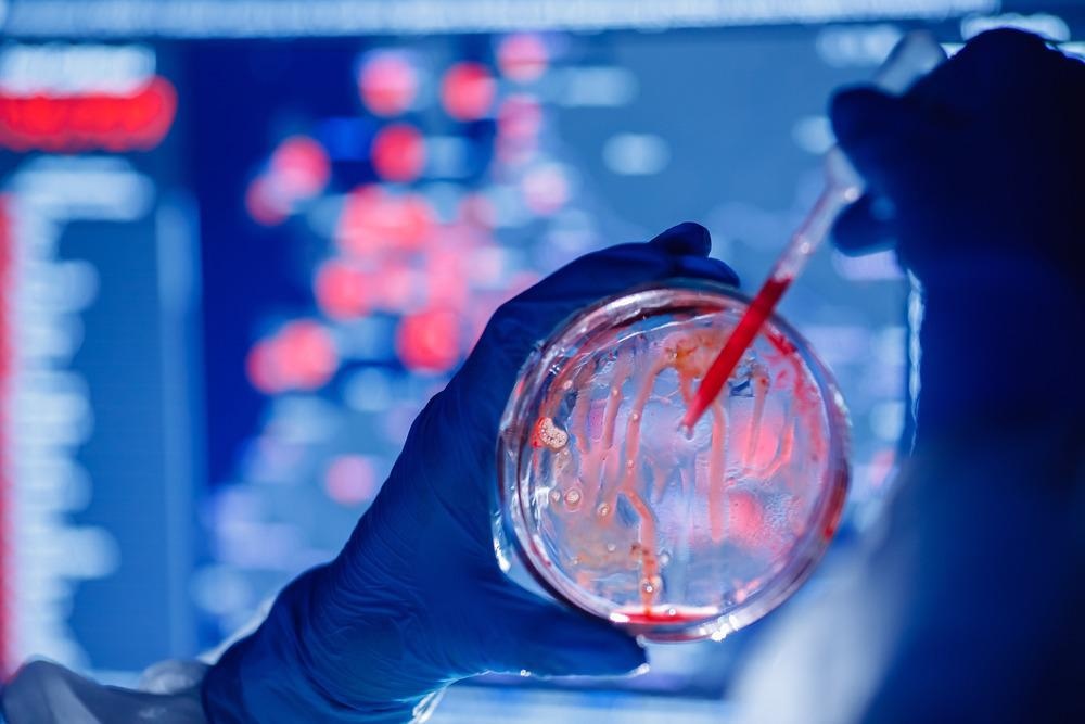 Using Nanotechnology to Detect Antimicrobial Resistance