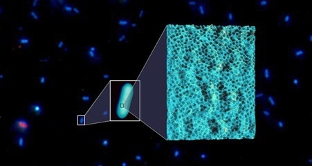 Background image: fluorescently labelled bacteria. Inset: single bacterium imaged with JPK NanoWizard® V BioAFM. High-resolution inset: PeakForce-QI topography image, longer side 250 nm, height range 3 nm.