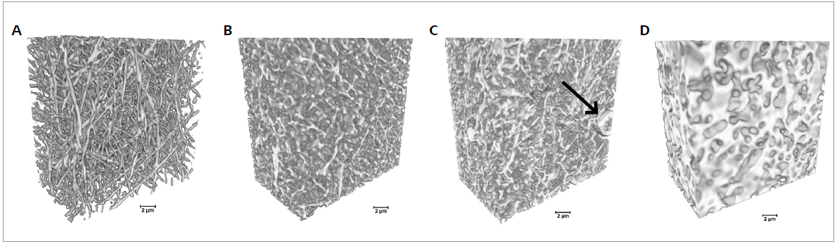 3D imaging of electrospun gelatin fibers cross-linked for different times using Xradia 810 Ultra. The cross-linking duration increase from 0 min (pristine gelatin sample) to 60, 90, and 120 min from A to D , respectively. Arrow indicates a bead in the fibrous mats (scale bar: 2 µm).