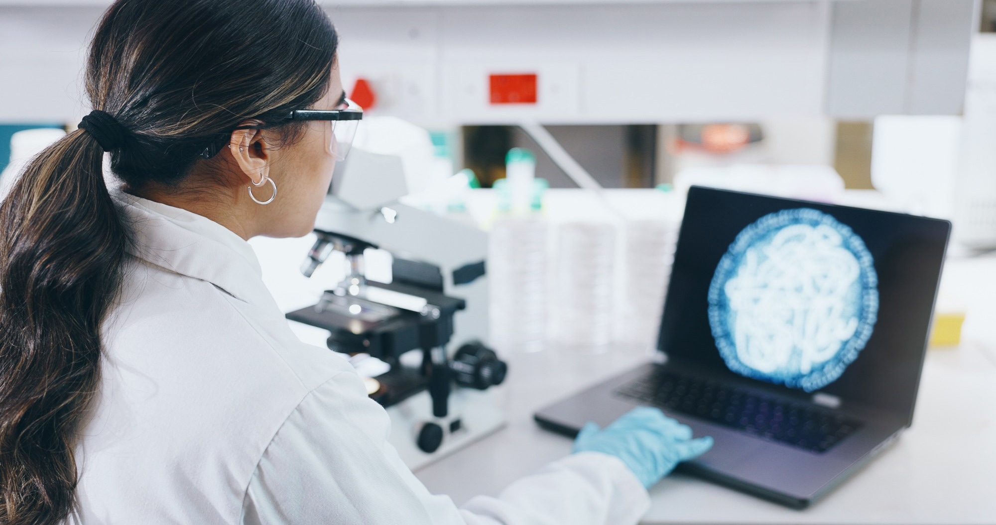 A female scientist in a white lab coat and gloves is looking at a laptop displaying a digital image of microbes, while a microscope sits on the desk in front of her in a laboratory setting.