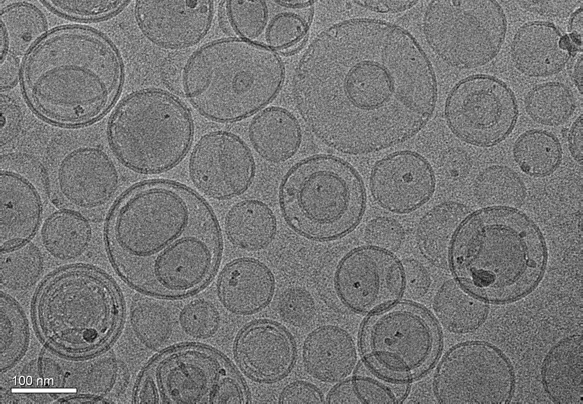 Liposomes microscope image with nanoparticles targeted treatment.