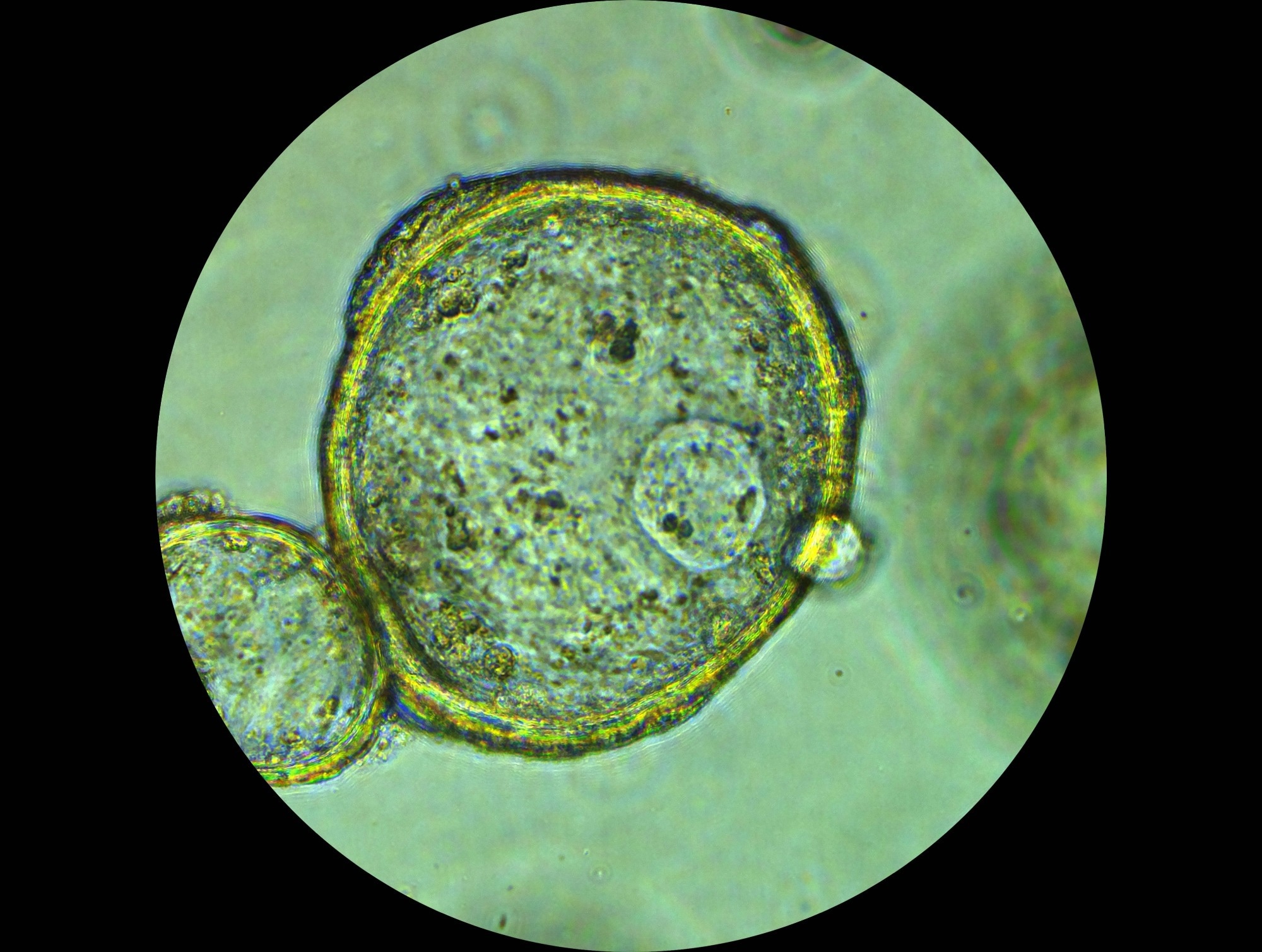 An image of a tumor organoid under a microscope, edited with green colour to improve visualization.