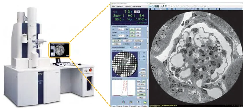 Advancing Electron Microscopy Research
