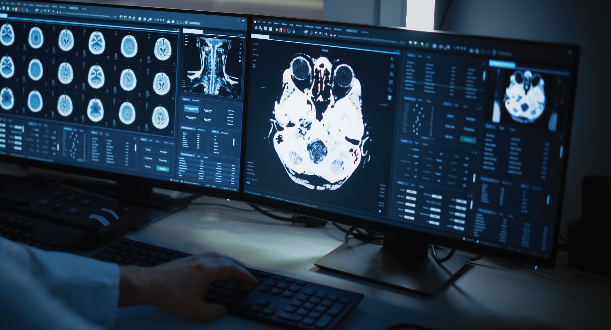 Bioimaging brain scan.