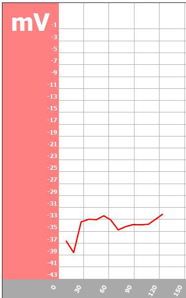 Black ink zeta potential = -32.1 mV.