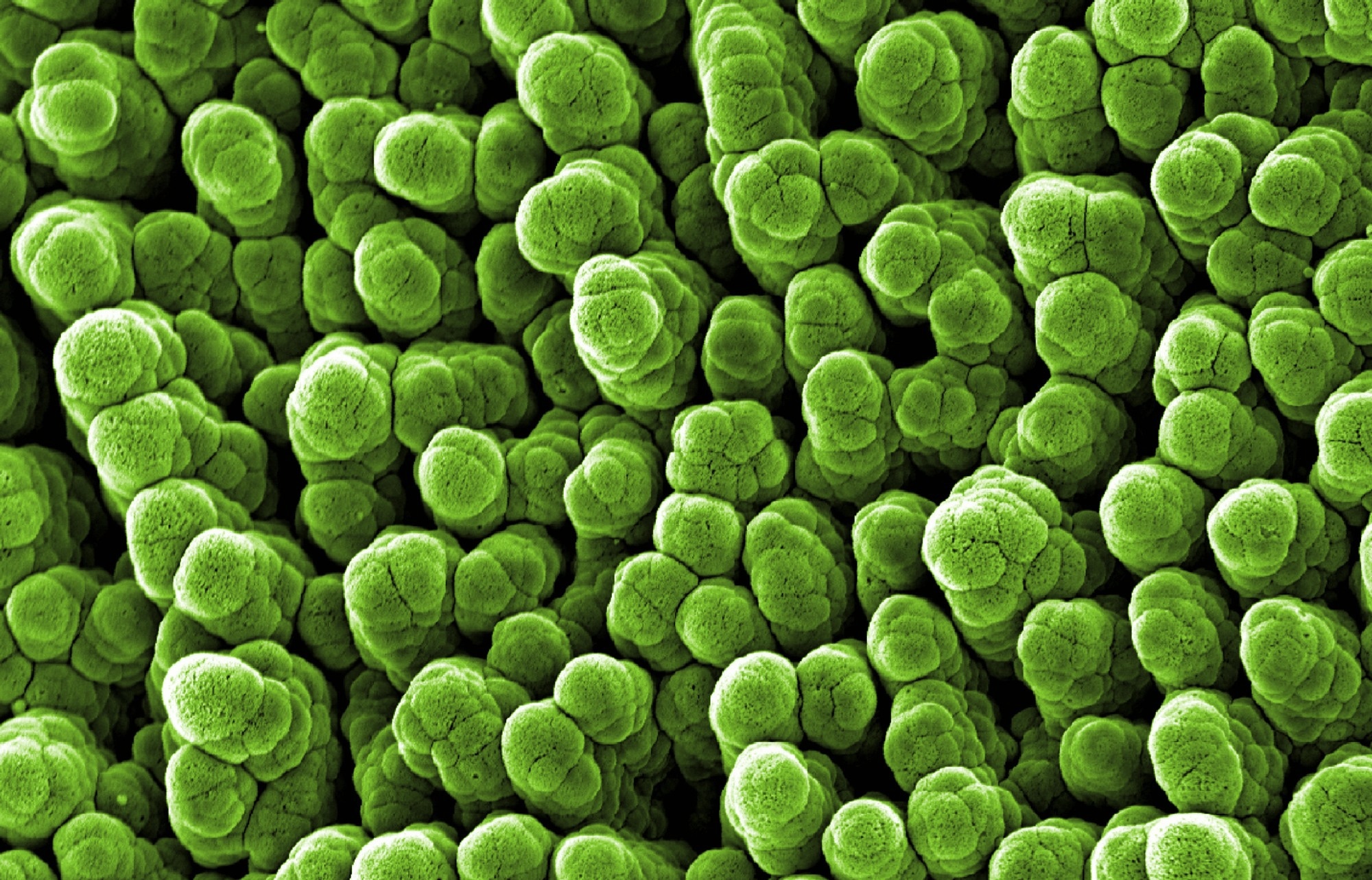 Atomic scale image of aluminum, representative of a surface scanning tunneling microscopy image.