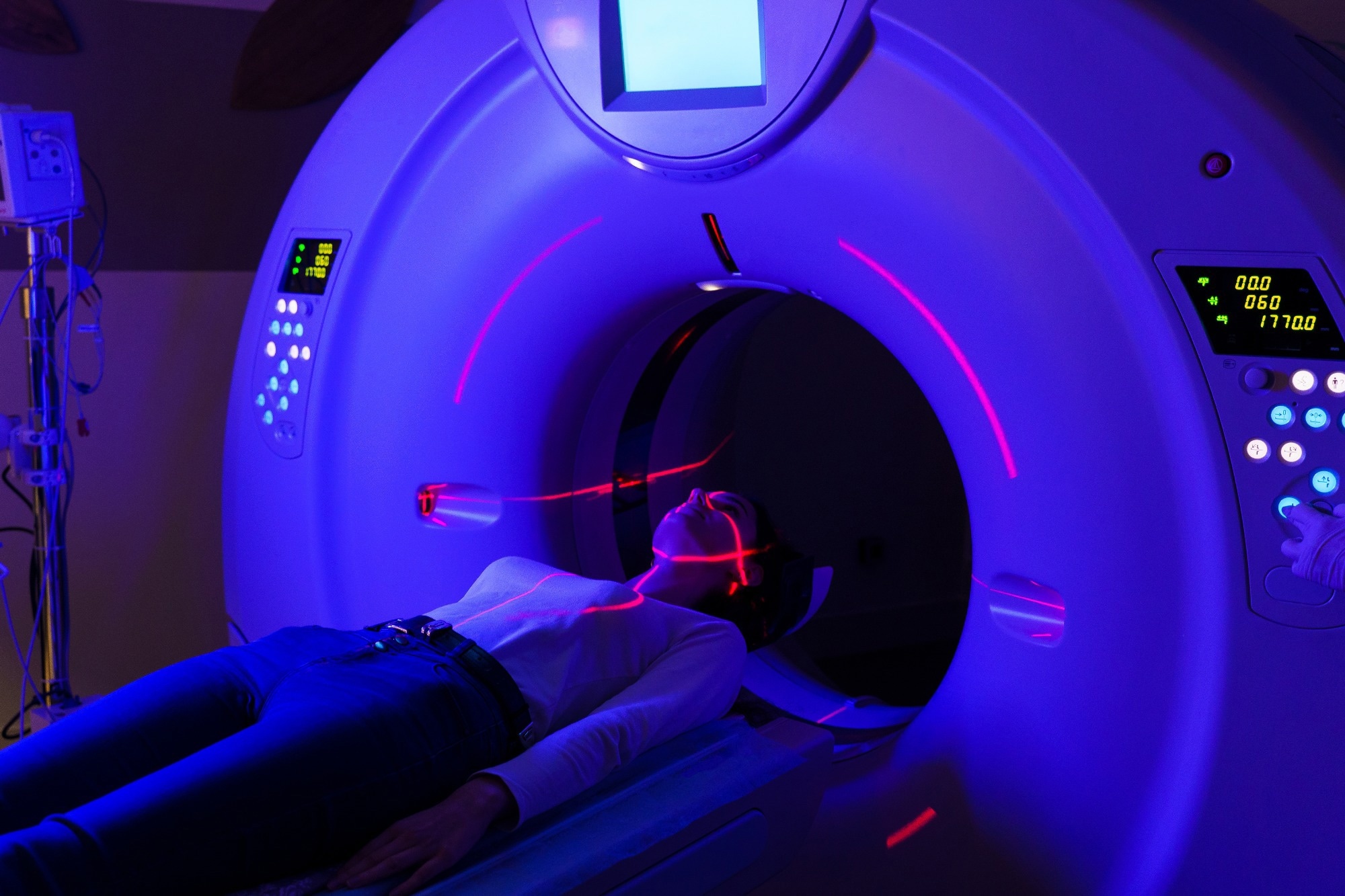 A woman lies on a bed for radiotherapy scan