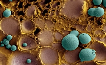 Scanning Electron Microscopes and Image Processors