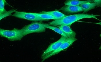 UV-Vis Microspectroscopy of Protein Crystals