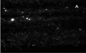 Direct Visualization, Sizing and Counting of Exosomes Using Nanoparticle Tracking Analysis