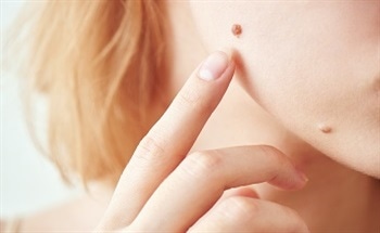 Nanotechnology and Dermatology - The Role of Nanotechnology in Dermatology Research