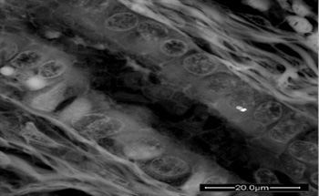 A New Word to Describe the Nanoparticle-Human Body Interaction