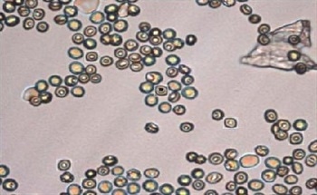 Red Blood Cell Analysis Using Ultraviolet Microspectroscopy