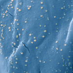 Silver Nanoparticles as Antimicrobial Agent