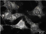 Analyzing Nanoparticles in Cancer Cells Using Darkfield Hyperspectral  Imaging