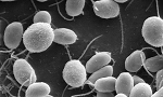 The History and Working Principle of the SEM