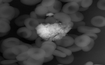 Nanotoxicology and Particle Toxicology