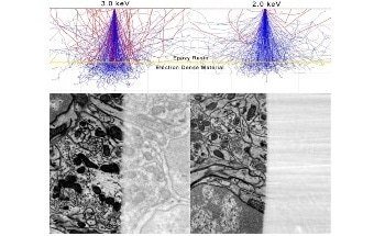 Optimizing 3D Electron Microscopy (3DEM) Results at a Low kV