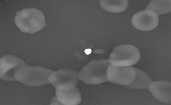 Nanopathology - A New Revolutionary Approach to Medicine
