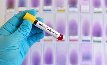 Commercially Available Microarray for “Bird Flu” Available From Combimatrix - New Product