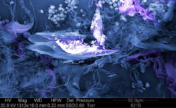 What are the Advances  in Nanopathology?