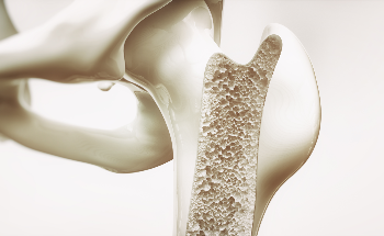 Characterizing Nanocomposites in Bones with the Use of X-Ray Diffraction