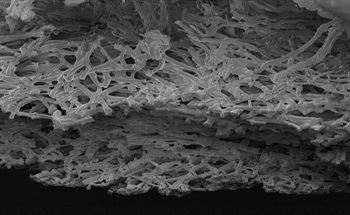 A Guide to Atomic Force Microscopy (AFM) and Transmission Electron Microscopy (TEM)