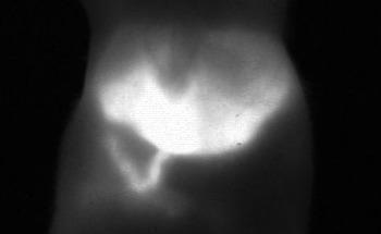 In Vivo NIR-II Imaging in Preclinical Research