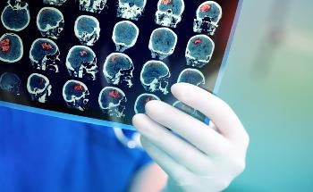 Next-Generation Graphene Bioelectronics for Targeting Severe Chronic Diseases