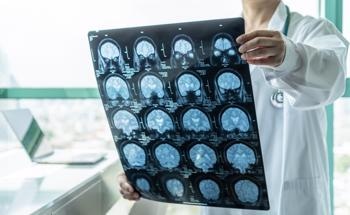 Gold Nanoparticles in Mass Spectrometry: Enabling Neurological Research
