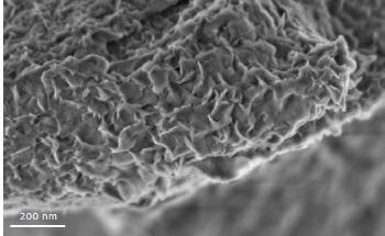 The Evolution of Scanning Electron Microscopy