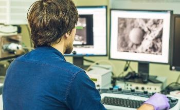 Electron Microscopy in MXene Research