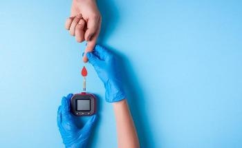 Comparing GOx Immobilization Methods to Improve Glucose Biosensing