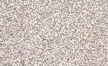 Nanoindentation Analysis of Ceramic Materials