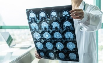 Graphene Oxide Therapeutics For Neurodegenerative Conditions