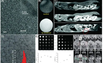 Non-Invasive Bioimaging Developments with Magnetic Iron Oxide Nanoparticles