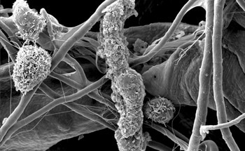 Correlative Microscopy: Combining Techniques for Deeper Insight