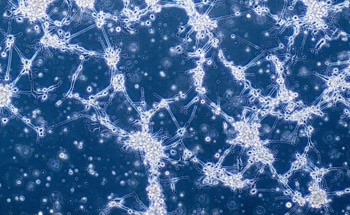 Nanoscale Tools for Tumor Physiology Research