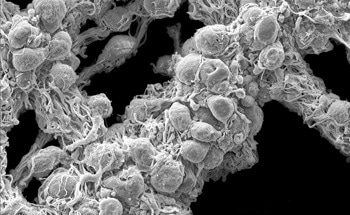 Electron Microscopy in Industry: Quality Control and Failure Analysis