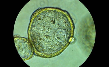 Nanoparticle Drug Development with Organoid Platforms