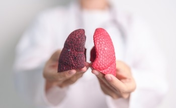 Can Nanoparticles Solve the Drug-Delivery Problem in Lung Disease?