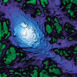 Neuron from mouse hippocamp 10 × 10 × 6.3 μm.