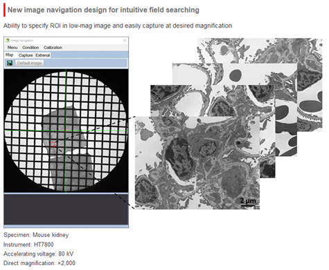 HT7800: A Fully Digital, Versatile Transmission Electron Microscope