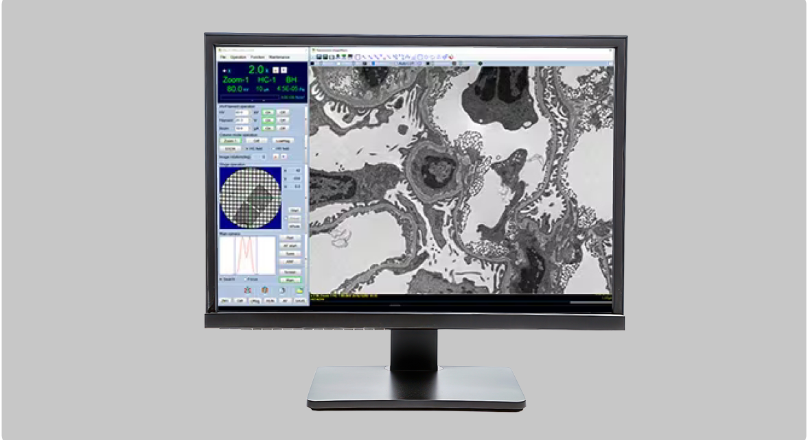 HT7800: A Fully Digital, Versatile Transmission Electron Microscope