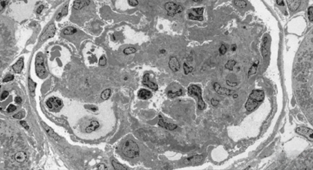 Mouse Kidney (stained), accelerating voltage 80 kV, magnification x300.