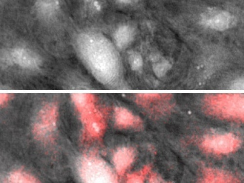 UPDATES - Lyncée Reflection Series: Time-Resolved Advanced Topography Solutions