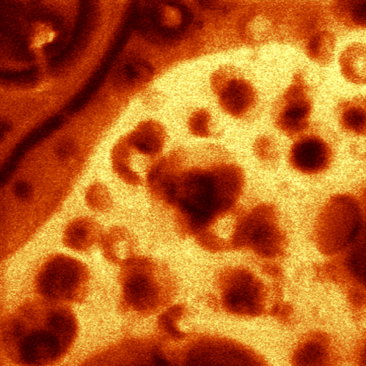 SNOM image of a two-phase polymer mixture.