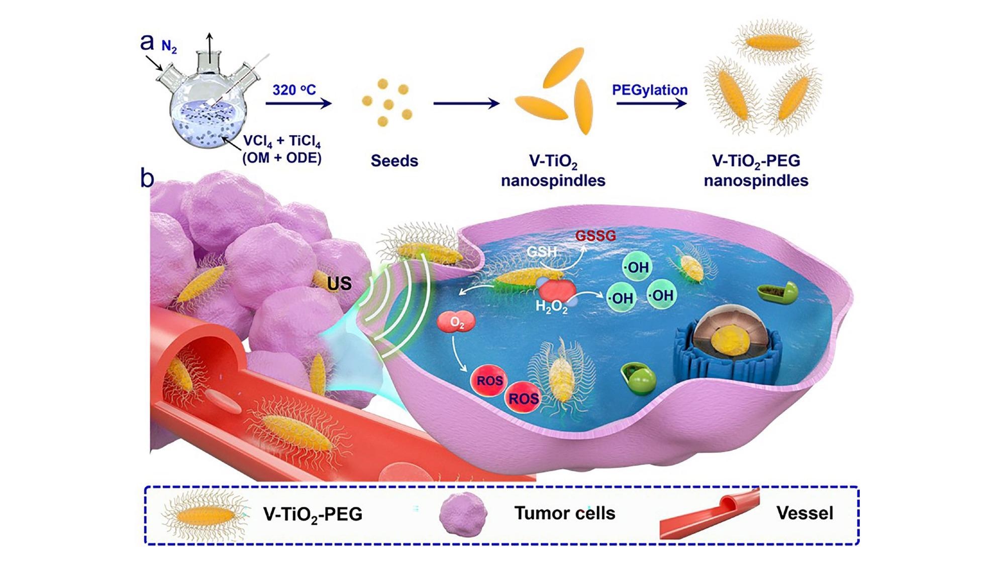 V-TiO2 nanospindles encased in polyethylene glycol (PEG) and used in combination with ultrasound waves can kill cancer cells.