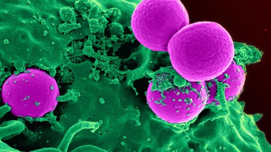Combination of Nanoparticles and Bioglass can Help Fight Harmful Bacteria