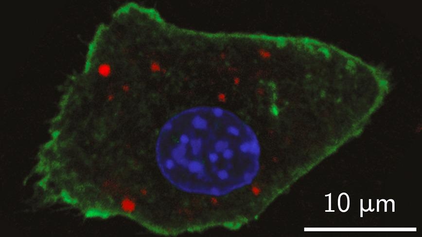 New Nanoparticle Contrast Agents Could Help Better Identify Tumors